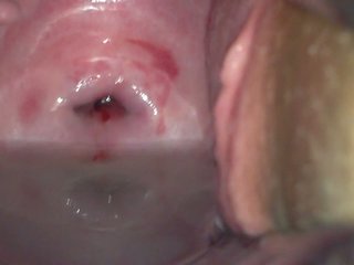 Cervix: faraj & amatur hd lucah video f6